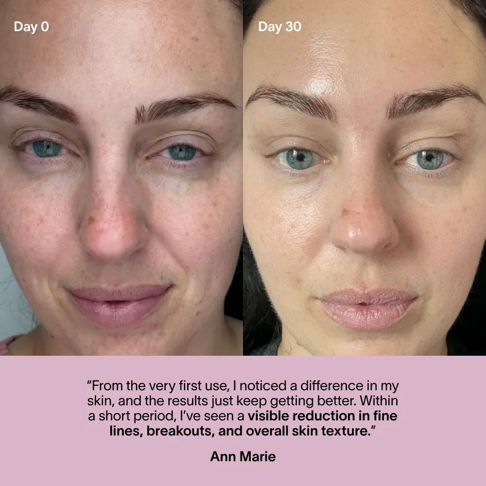 Wrinkle Retreat Face Mask & Lightboost Serum Kit